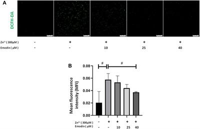 Emodin Protects SH-SY5Y Cells Against Zinc-Induced Synaptic Impairment and Oxidative Stress Through the ERK1/2 Pathway